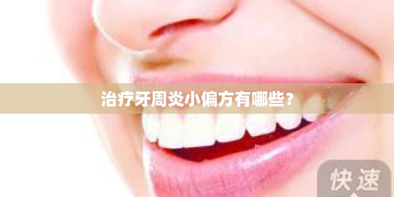 治疗牙周炎小偏方有哪些？