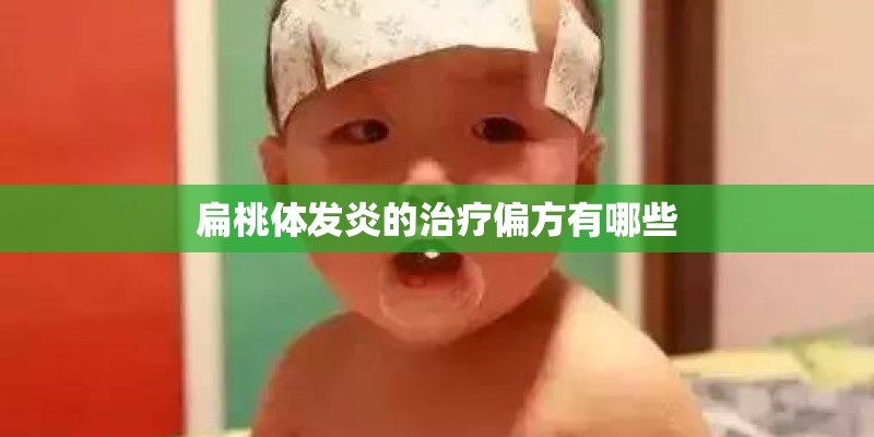 扁桃体发炎的治疗偏方有哪些