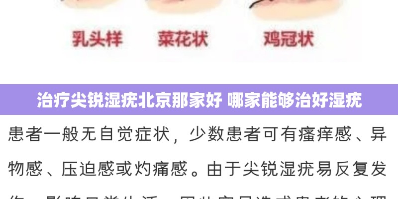 治疗尖锐湿疣北京那家好 哪家能够治好湿疣