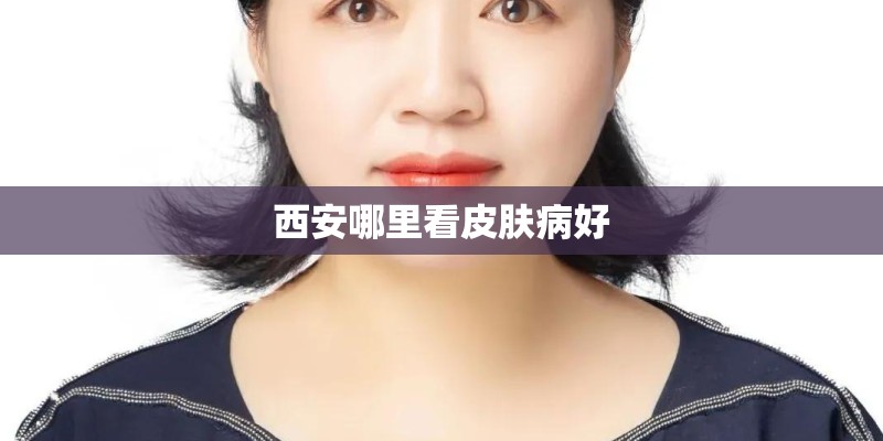 西安哪里看皮肤病好