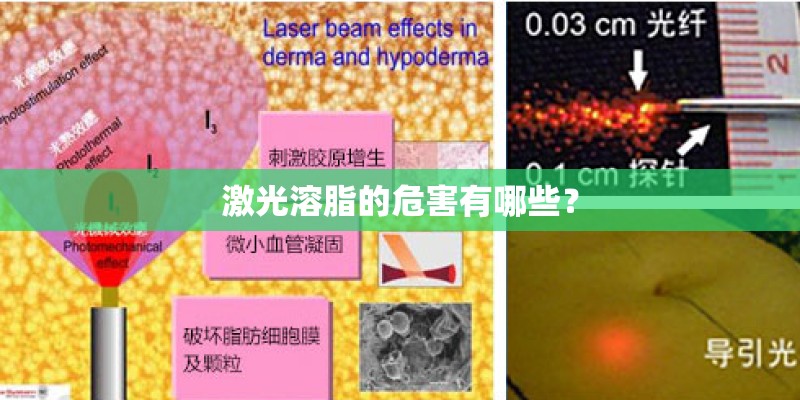 激光溶脂的危害有哪些？