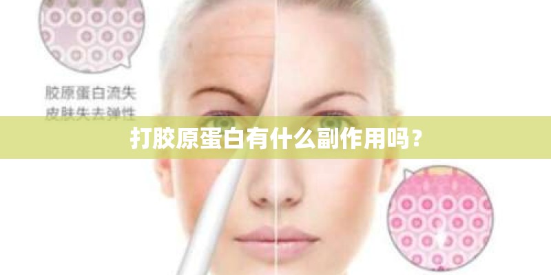打胶原蛋白有什么副作用吗？