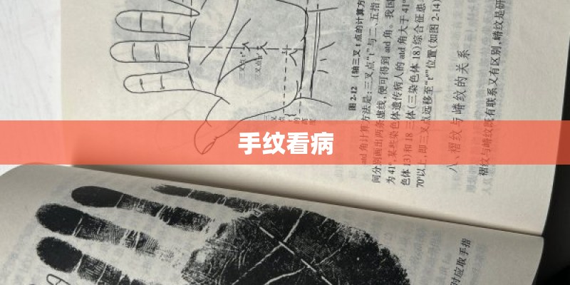 手纹看病