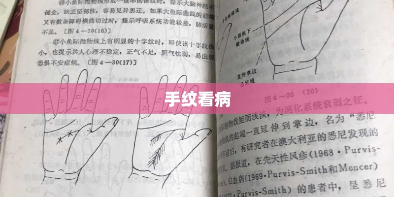 手纹看病