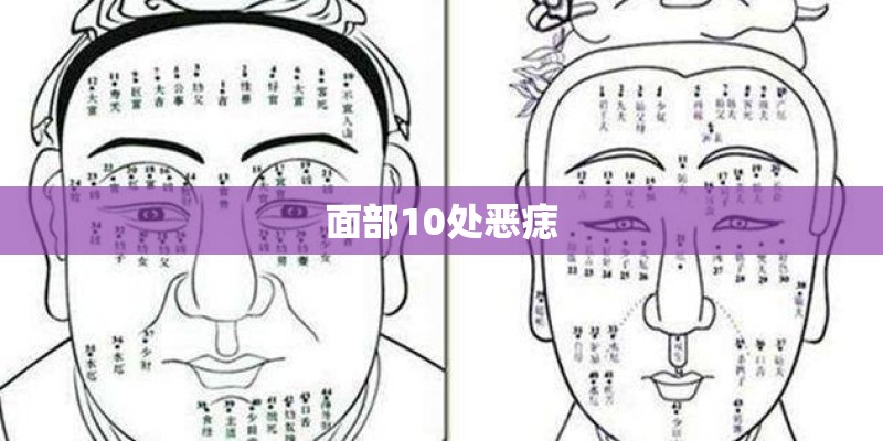 面部10处恶痣